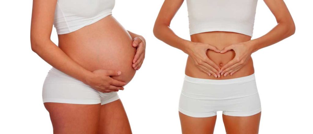 En este momento estás viendo Abdominoplastia después del parto por cesárea: ¿cuáles son los beneficios?